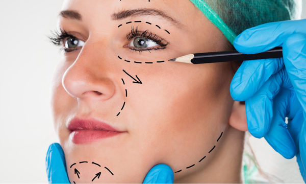 Facelift without surgery