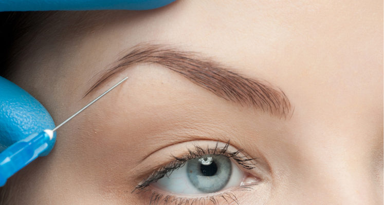 Botox Eyebrow Lift: Non-Surgical Option for Higher Brows