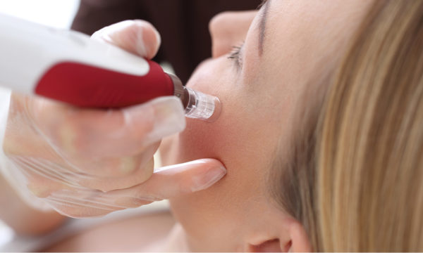 PRP Microneedling