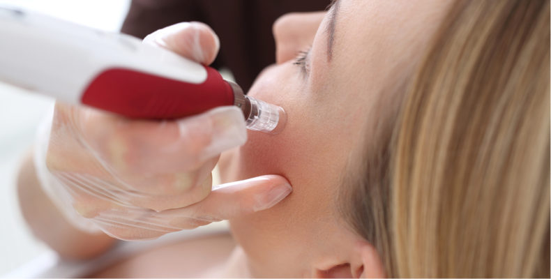 PRP Microneedling