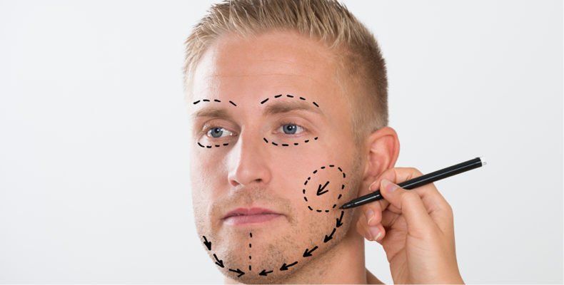 Jawline Filler and Other Tips for a Chiseled Masculine Face