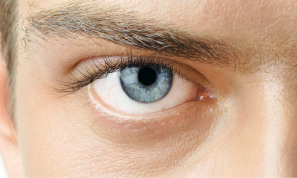 Eradicate Dark Under Eye Circles: 3 Tips to Look More Refreshed