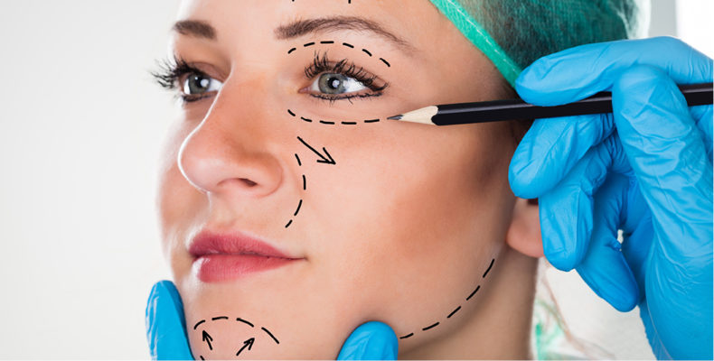Facelift without surgery
